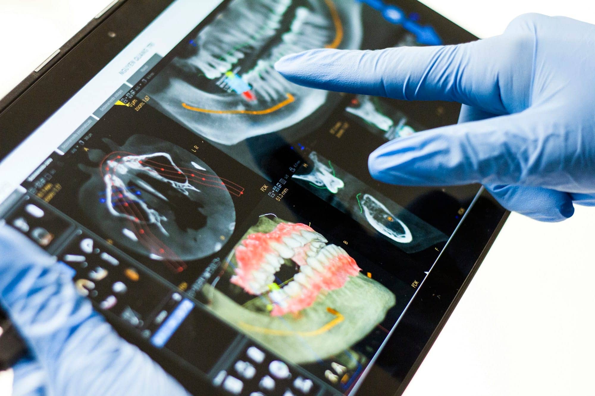 Analyse d’une radiographie et d’un modèle dentaire 3D sur tablette